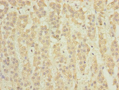 TCTA Antibody