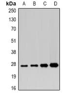 APIP Antibody