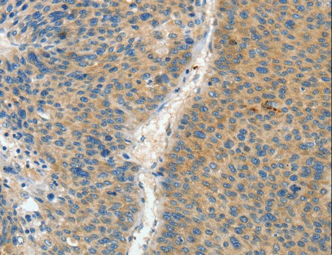 Polyclonal Rabbit anti-Human ASPA Antibody (IHC, WB)
