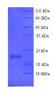 Mouse IFNE / Interferon Epsilon Protein (Recombinant His)