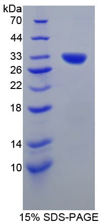 Mouse CNTNAP1 / CASPR / p190 Protein (Recombinant His-T7)
