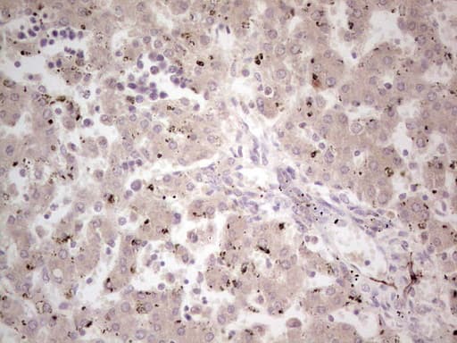 Monoclonal Mouse anti-Human NEFM / NF-M Antibody (clone OTI2G3, aa413-773, IHC, WB)
