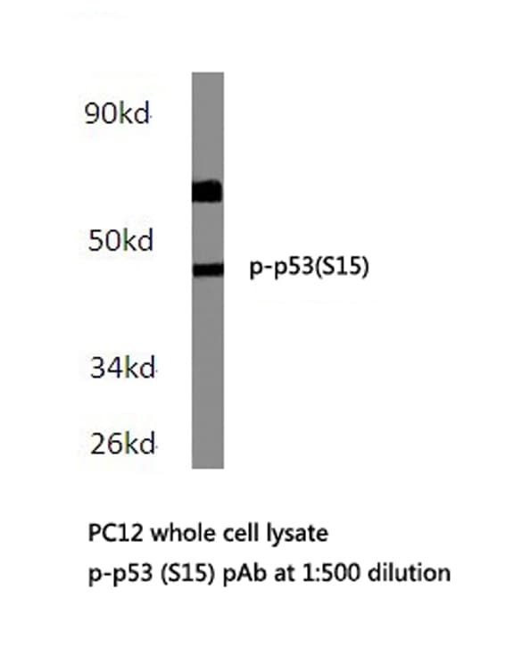 TP53 / p53 Antibody (phospho-Ser15)