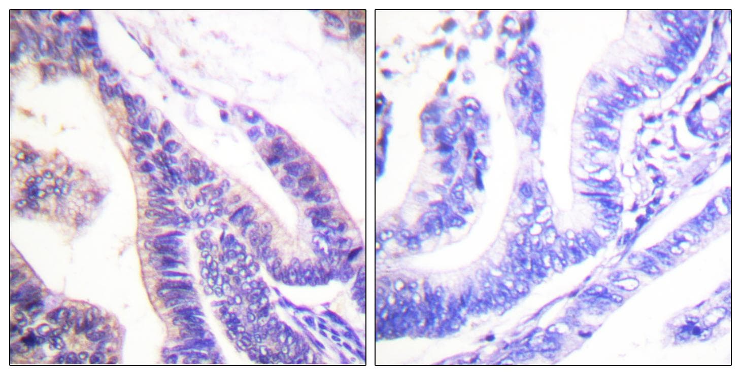 Polyclonal Rabbit anti-Human RPS6KB1 / P70S6K / S6K Antibody (p418, IHC, WB)