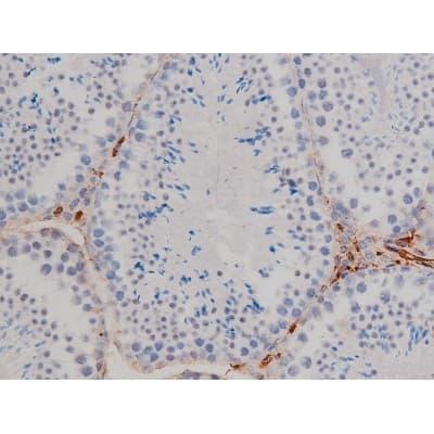 Polyclonal Rabbit anti-Human LYN Antibody (phospho-Tyr508, IHC, IF, WB)