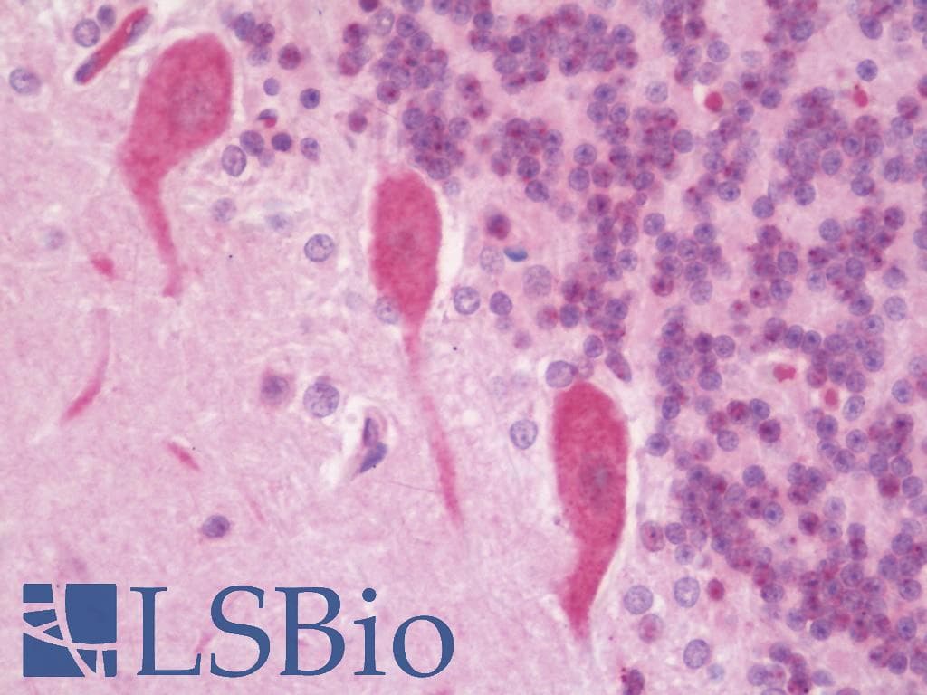 IHC-plus™ CCDC170 / C6orf97 Antibody (aa442-715)