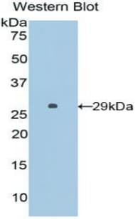 SFTPB / Surfactant Protein B Antibody (aa111-352, APC)