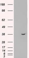 Monoclonal Mouse anti-Human MRI1 Antibody (clone OTI6G9, IHC, IF, WB)