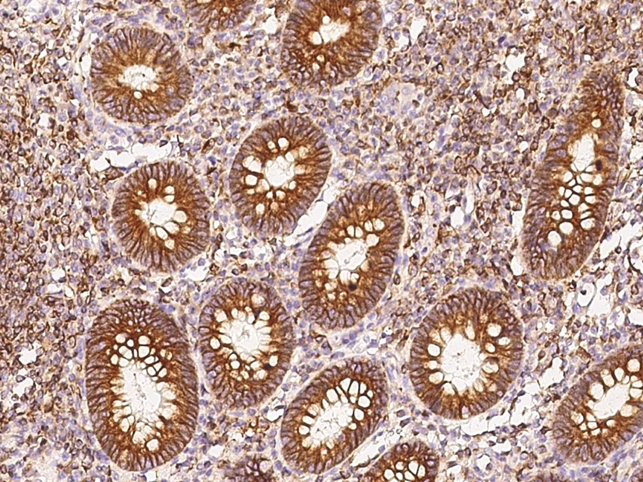 Polyclonal Rabbit anti-Human PD-L2 / PDCD1LG2 / CD273 Antibody (Preservative Free, IHC)