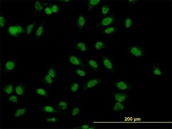 IHC-plus™ MBNL1 / MBNL Antibody (clone 3E7)