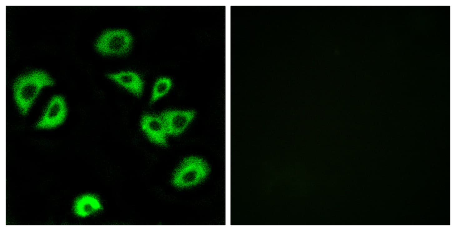 ILT3 / LILRB4 Antibody (aa201-250)