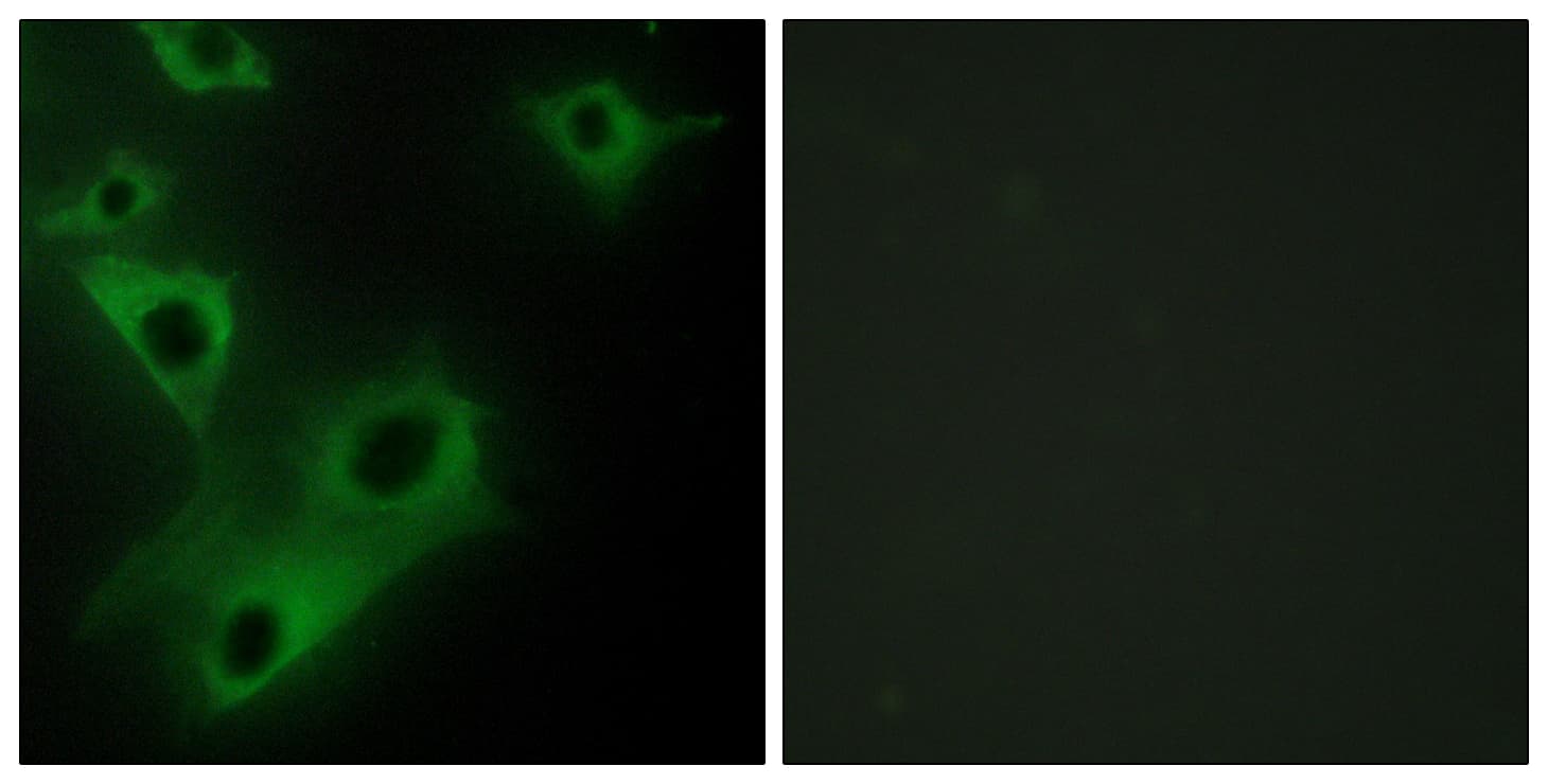 IHC-plus™ FSP27 / CIDEC Antibody (aa189-238)