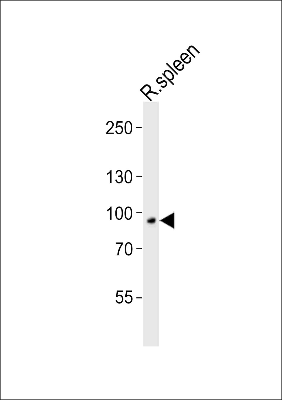 VAC14 / TRX Antibody (aa769-802)