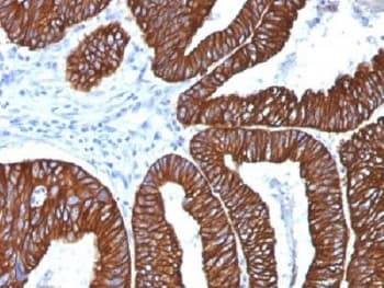 Cytokeratin 8+18 Antibody (clone 5D3)