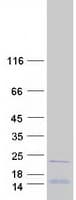 Human RPL26L1 Protein (Recombinant Myc-DDK (Flag))