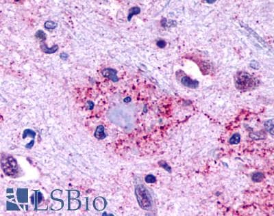 PathPlus™ Polyclonal Rabbit anti-Human GPR146 Antibody (Cytoplasmic Domain, IHC)