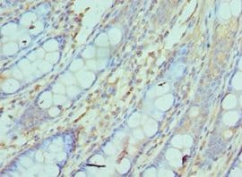 Polyclonal Rabbit anti-Human NCBP2 / CBP20 Antibody (aa1-156, IHC, WB)