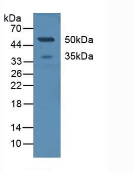 CLEC4M / L-SIGN / CD299 Antibody (aa242-399)