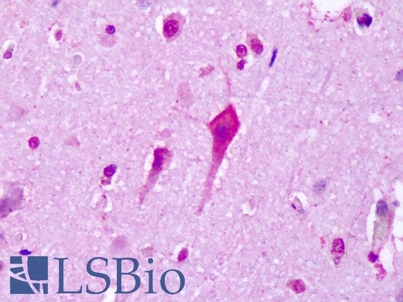 IHC-plus™ Polyclonal Rabbit anti-Human HTR7 / 5HT7 Receptor Antibody (C-Terminus, IHC, IF)