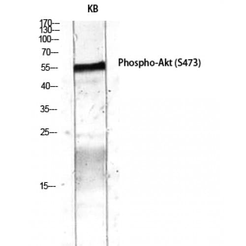 AKT1 Antibody (410-490 aa)