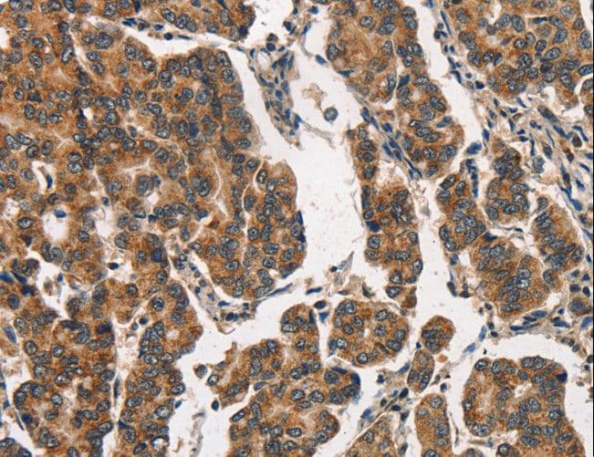 ITGA2 / CD49b Antibody