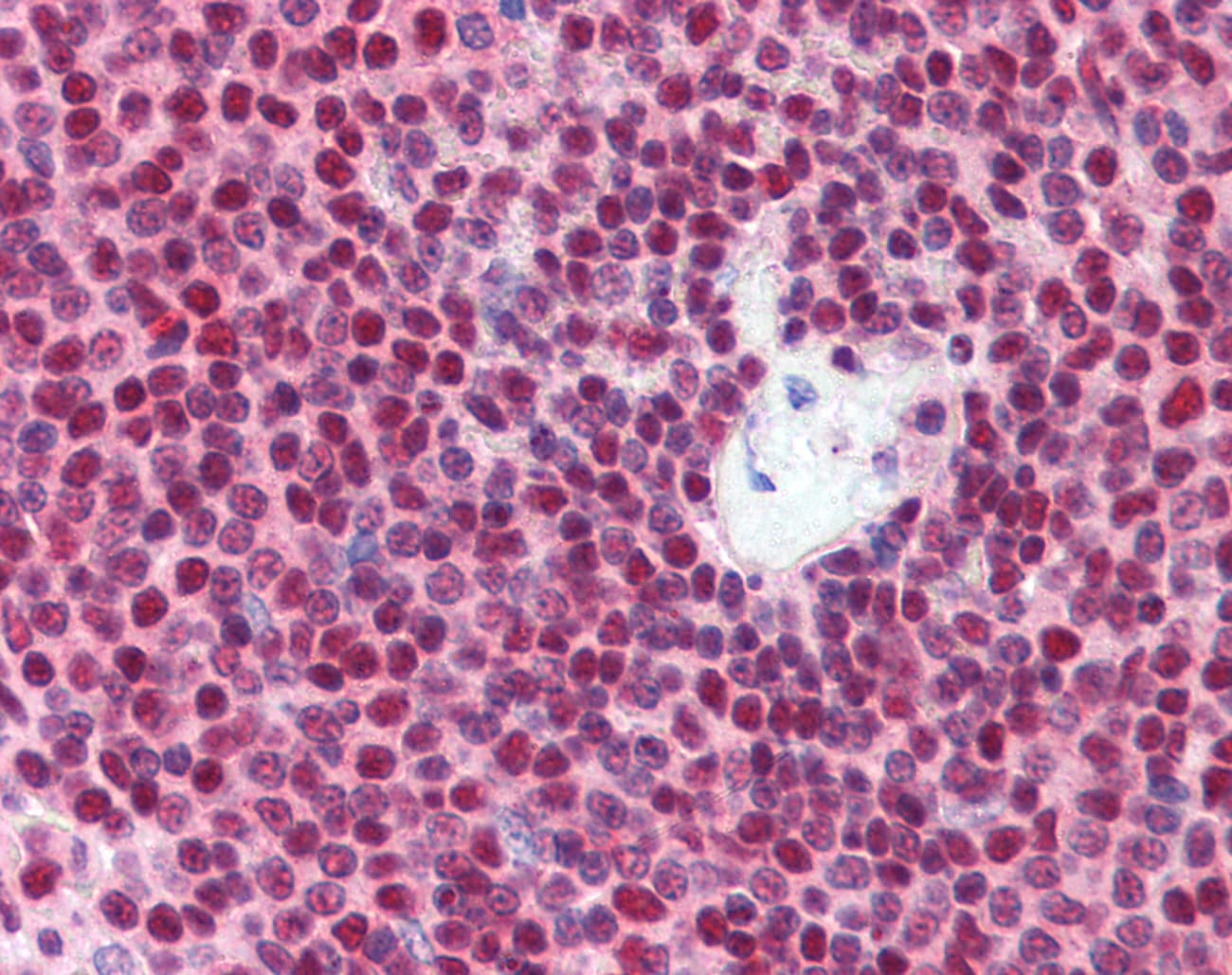 Polyclonal Rabbit anti-Human NKRF / NRF Antibody (C-Terminus, IHC, WB)