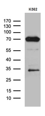 ALOX5 / 5-LOX Antibody (aa18-364, clone OTI1C1)