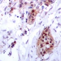 Polyclonal Rabbit anti-Human ER Alpha / Estrogen Receptor Antibody (IHC, WB)