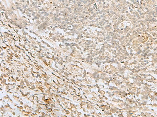 LYRM1 Antibody