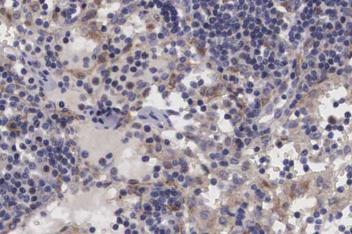 TRIM24 / TIF1 Antibody