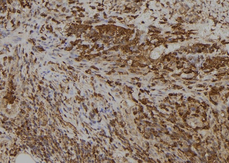 Polyclonal Rabbit anti-Human SLC5A5 / NIS Antibody (IHC, WB)