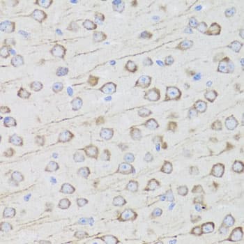 MIP / AQP0 / Aquaporin 0 Antibody
