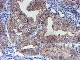 Monoclonal Mouse anti-Human ERBB2 / HER2 Antibody (clone OTI12G4, Carrier-free, aa676-1255, IHC, IF, WB)