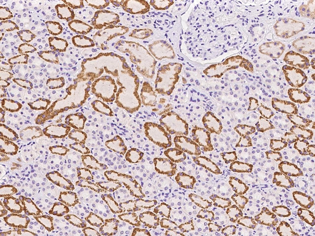 TMEM180 Antibody