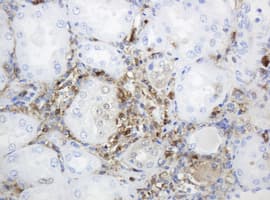 TP / Thymidine Phosphorylase Antibody (aa311-482, clone OTI1E7, Carrier-free)