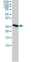 IHC-plus™ Monoclonal Mouse anti-Human PSMA7 Antibody (clone 1A10-3G12, IHC, IF, WB)