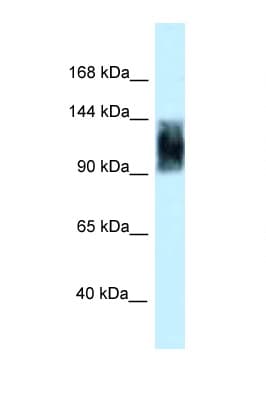 Polyclonal Rabbit anti-Rat SRRM1 Antibody (aa771-820, IHC, WB)
