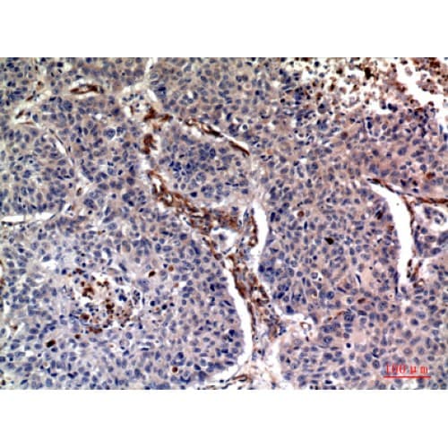 Ubiquitin Antibody (N-Terminal)