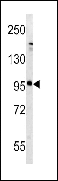 Polyclonal Rabbit anti-Human GRM5 / MGLUR5 Antibody (aa1020-1050, WB)