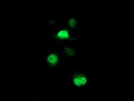Monoclonal Mouse anti-Human PSMB7 Antibody (clone OTI4G9, aa58-277, IF, WB)