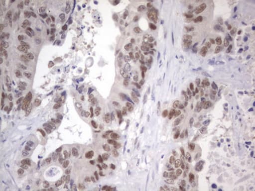 Monoclonal Mouse anti-Human APC Antibody (clone OTI1B12, aa955-1382, IHC)