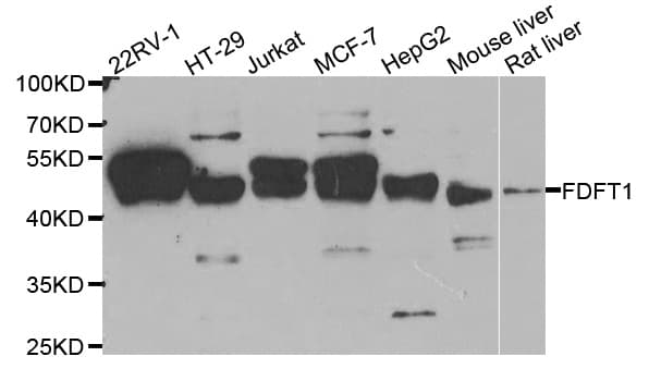 FDFT1 / Squalene Synthase Antibody
