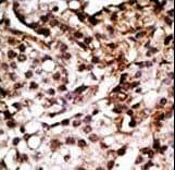 Polyclonal Rabbit anti-Human Apg7 / ATG7 Antibody (aa22-51, IHC, WB)