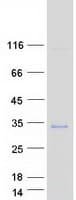 Human VTI1B Protein (Recombinant Myc-DDK (Flag))