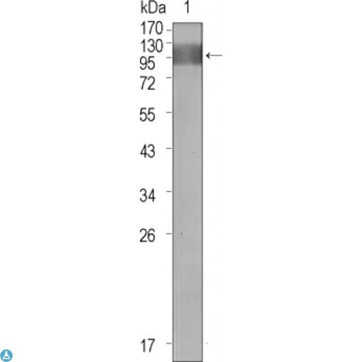 FLT1 / VEGFR1 Antibody