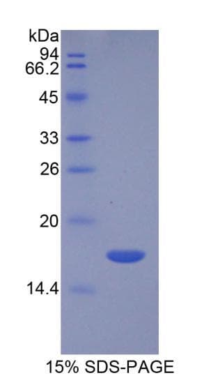 Human TGFB3 / TGF Beta3 Protein (Recombinant His-T7)