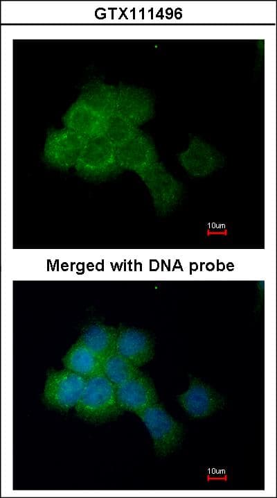 EEF2K Antibody (aa1-268)
