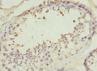 PPP2R1B Antibody