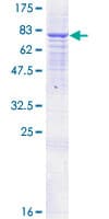 Human ANTXR2 / CMG2 Protein (Recombinant GST)