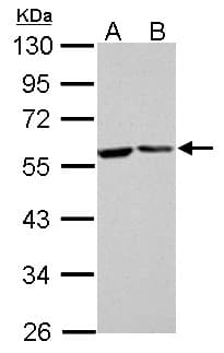 FKBP4 / FKBP52 Antibody (aa1-207)
